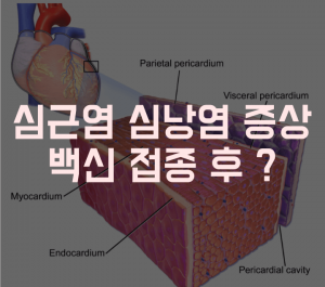 심근염-심낭염-증상-썸네일