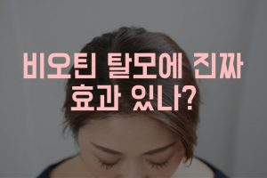 비오틴 탈모 효능